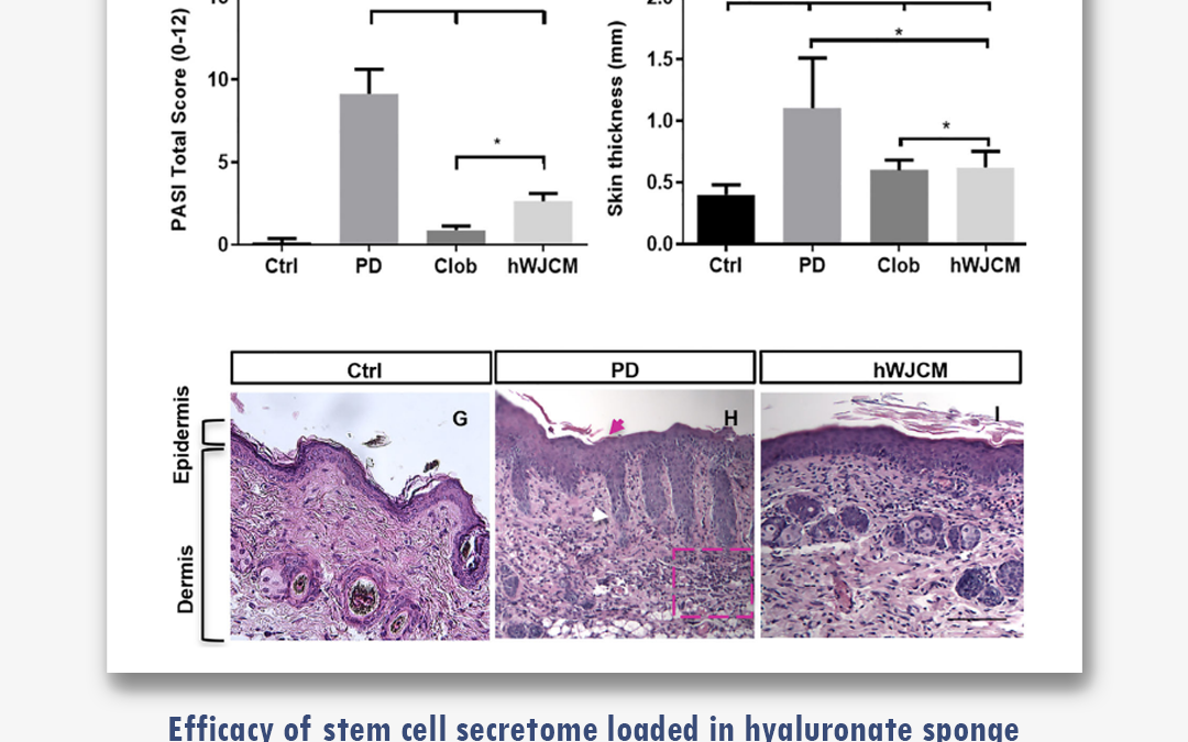 Efficacy of stem cell secretome loaded in hyaluronate sponge for topical treatment of psoriasis