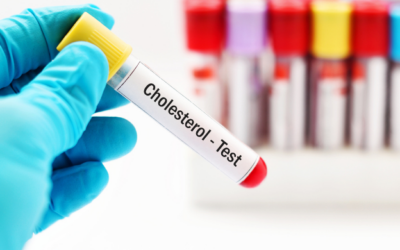 Colesterol alto: ¿cambios de hábitos, medicamentos o ambos?